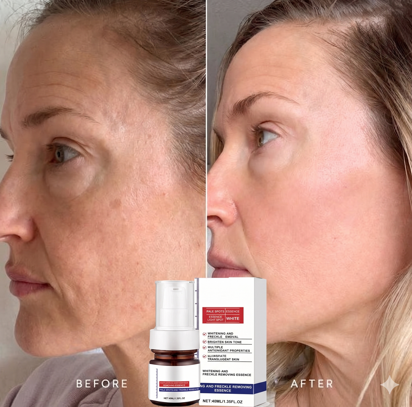 【Dermatologist-Recommended】 VC Spot-Correction & Whitening Cream Set
