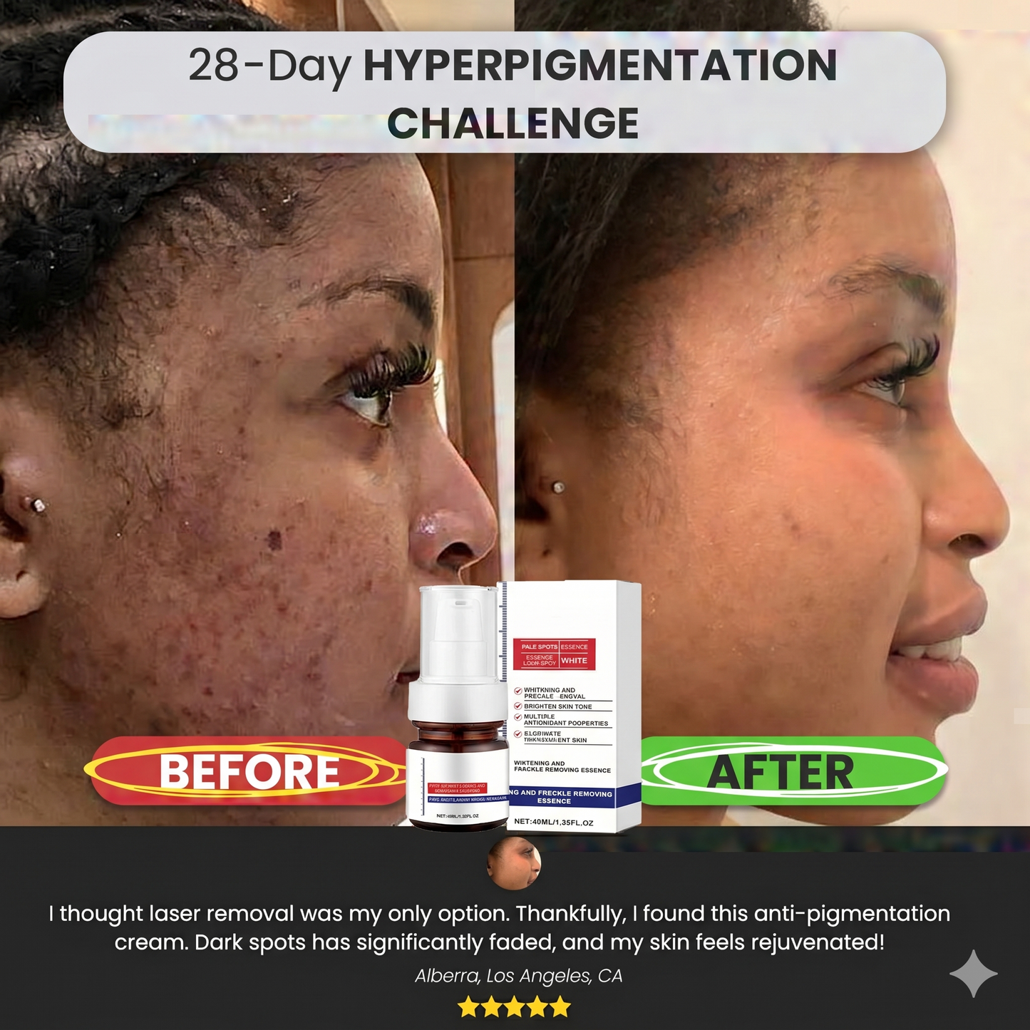 【Dermatologist-Recommended】 VC Spot-Correction & Whitening Cream Set