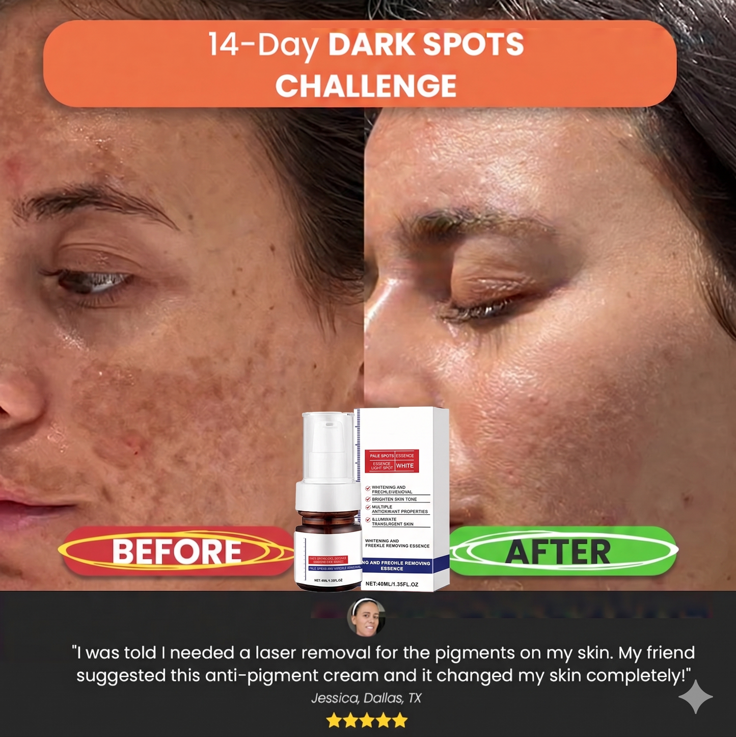 【Dermatologist-Recommended】 VC Spot-Correction & Whitening Cream Set