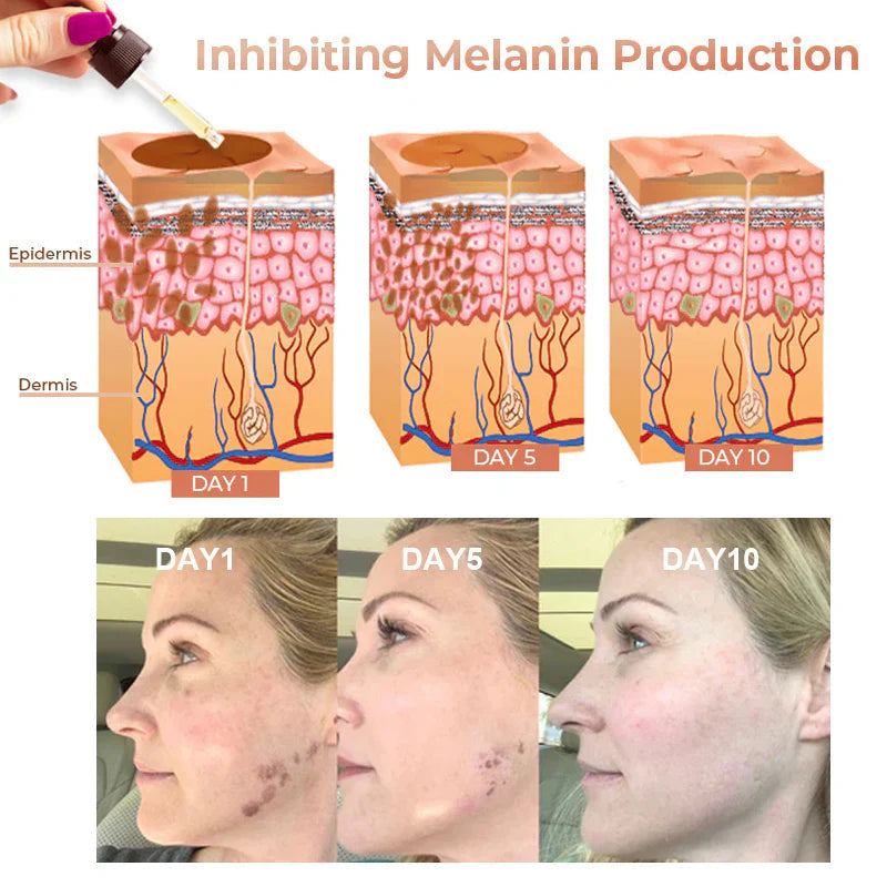 【Dermatologist-Recommended】 VC Spot-Correction & Whitening Cream Set